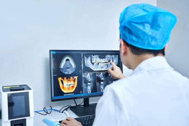 Best Emergency Wisdom Teeth Removal in Owingsville, KY